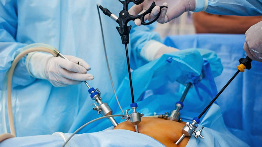 Laparoscopic hysterectomy & Ovarian Surgeries